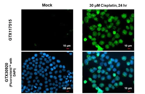 p53 (mono-methyl Lys372) antibody detects p53 (mono-methyl Lys372) protein at nucleus and endoplasmic reticulum by immunofluorescent analysis. Sample: Mock and treated HCT116 cells were fixed in 4% paraformaldehyde at RT for 15 min. Green: p53 (mono-methyl Lys372) stained by p53 (mono-methyl Lys372) antibody (GTX117515) diluted at 1:500. Blue: Fluoroshield with DAPI (GTX30920). p53 (mono-methyl Lys372) antibody detects p53 (mono-methyl Lys372) protein at nucleus and endoplasmic reticulum by immunofluorescent analysis. Sample: Mock and treated HCT116 cells were fixed in 4% paraformaldehyde at RT for 15 min. Green: p53 (mono-methyl Lys372) stained by p53 (mono-methyl Lys372) antibody (GTX117515) diluted at 1:500. Blue: Fluoroshield with DAPI (GTX30920).