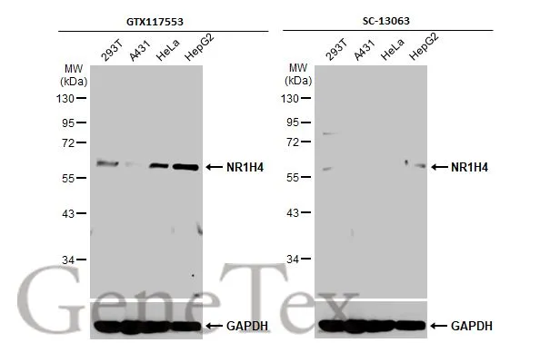Various whole cell extracts (30 μg) were separated by 10% SDS-PAGE, and the membranes were blotted with NR1H4 antibody (GTX117553) diluted at 1:500 and competitor's antibody (sc-13063) diluted at 1:500. The HRP-conjugated anti-rabbit IgG antibody (GTX213110-01) was used to detect the primary antibody. *The competitor is not affiliated with GeneTex and does not endorse this product.