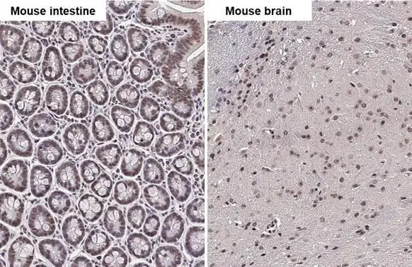NR1H4 antibody detects NR1H4 protein by immunohistochemical analysis. Sample: Paraffin-embedded mouse tissues. NR1H4 stained by NR1H4 antibody (GTX117553) diluted at 1:500. Antigen Retrieval: Citrate buffer, pH 6.0, 15 min