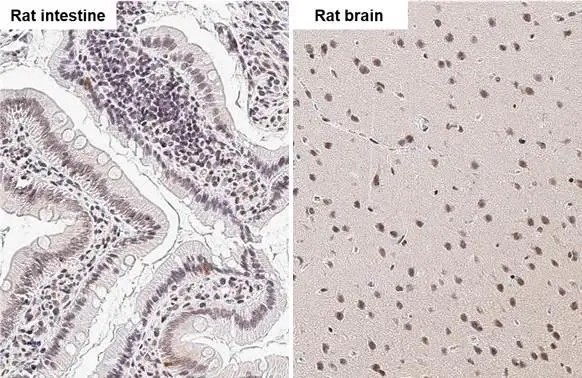 NR1H4 antibody detects NR1H4 protein by immunohistochemical analysis. Sample: Paraffin-embedded rat tissues. NR1H4 stained by NR1H4 antibody (GTX117553) diluted at 1:500. Antigen Retrieval: Citrate buffer, pH 6.0, 15 min