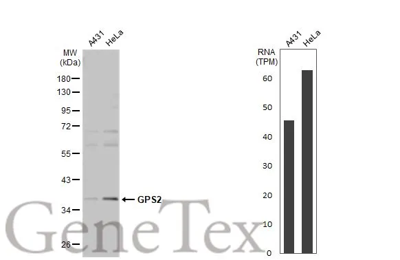 Various whole cell extracts (30 μg) were separated by 10% SDS-PAGE, and the membrane was blotted with GPS2 antibody (GTX117560) diluted at 1:500. The HRP-conjugated anti-rabbit IgG antibody (GTX213110-01) was used to detect the primary antibody. Corresponding RNA expression data for the same cell lines are based on Human Protein Atlas program.