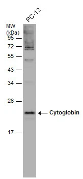 Whole cell extract (30 μg) was separated by 12% SDS-PAGE, and the membrane was blotted with Cytoglobin antibody (GTX117571) diluted at 1:1000.