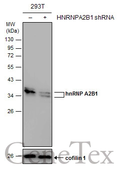hnRNP A2B1 antibody