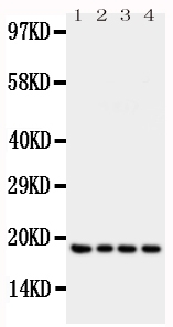WB analysis of various samples using GTX11759 Interferon gamma antibody. Lane 1 : Recombinant human IFN gamma protein 10ng Lane 2 : Recombinant human IFN gamma protein 5ng Lane 3 : Recombinant human IFN gamma protein 2.5ng Lane 4 : Recombinant human IFN gamma protein 1.25ng Dilution : 0.5 microg/mL WB analysis of various samples using GTX11759 Interferon gamma antibody. Lane 1 : Recombinant human IFN gamma protein 10ng Lane 2 : Recombinant human IFN gamma protein 5ng Lane 3 : Recombinant human IFN gamma protein 2.5ng Lane 4 : Recombinant human IFN gamma protein 1.25ng Dilution : 0.5 microg/mL