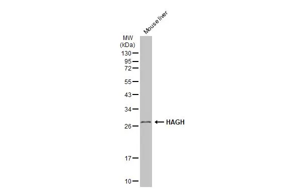 Mouse tissue extract (50 μg) was separated by 12% SDS-PAGE, and the membrane was blotted with HAGH antibody (GTX117595) diluted at 1:1000. The HRP-conjugated anti-rabbit IgG antibody (GTX213110-01) was used to detect the primary antibody, and the signal was developed with Trident ECL plus-Enhanced.