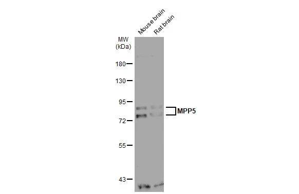 Various tissue extracts (30 μg) were separated by 7.5% SDS-PAGE, and the membrane was blotted with MPP5 antibody [N1N2], N-term (GTX117597) diluted at 1:1000. The HRP-conjugated anti-rabbit IgG antibody (GTX213110-01) was used to detect the primary antibody.