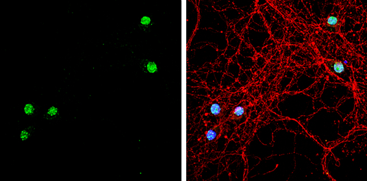 TBR1 antibody [N2C1], Internal detects TBR1 protein by immunofluorescent analysis. Sample: DIV9 rat E18 primary hippocampal neuron cells were fixed in 4% paraformaldehyde at RT for 15 min. Green: TBR1 stained by TBR1 antibody [N2C1], Internal (GTX117615) diluted at 1:500. Red: beta Tubulin 3/ Tuj1, stained by beta Tubulin 3/ Tuj1 antibody [GT1338] (GTX631831) diluted at 1:500. Blue: Fluoroshield with DAPI (GTX30920).