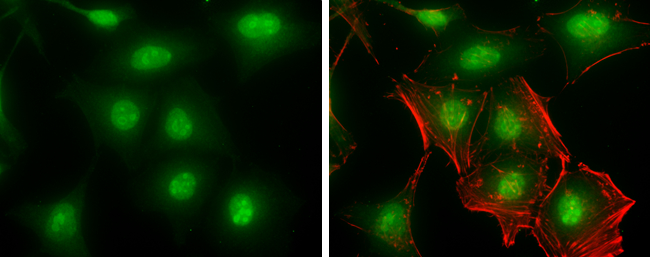 PNMA2 antibody detects PNMA2 protein at nucleolus and nucleolus by immunofluorescent analysis. Sample: HeLa cells were fixed in 4% paraformaldehyde at RT for 15 min. Green: PNMA2 stained by PNMA2 antibody (GTX117650) diluted at 1:500. Red: phalloidin, a cytoskeleton? marker, diluted at 1:100.