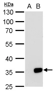 Galectin 8 antibody detects Galectin 8 protein by western blot analysis. A. 30 μg 293T whole cell lysate/extract B. 30 μg whole cell lysate/extract of human LGALS8-transfected 293T cells 10% SDS-PAGE Galectin 8 antibody (GTX117687) dilution: 1:5000 The HRP-conjugated anti-rabbit IgG antibody (GTX213110-01) was used to detect the primary antibody.