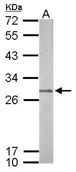 Sample (50 μg of whole cell lysate) A: mouse brain 12% SDS PAGE GTX117690 diluted at 1:1000 The HRP-conjugated anti-rabbit IgG antibody (GTX213110-01) was used to detect the primary antibody.