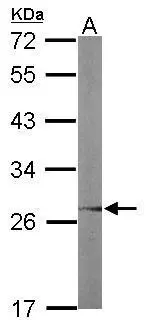Sample (50 ug of whole cell lysate) A: mouse liver 12% SDS PAGE GTX117722 diluted at 1:1000