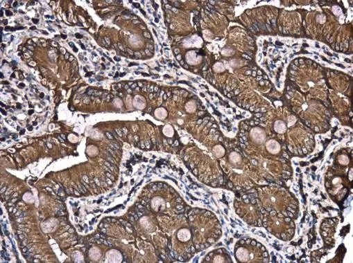 PATJ antibody [N1N2], N-term detects PATJ protein at cytoplasm in rat duodenum by immunohistochemical analysis. Sample: Paraffin-embedded rat duodenum. PATJ antibody [N1N2], N-term (GTX117767) diluted at 1:500. 
 Antigen Retrieval: Citrate buffer, pH 6.0, 15 min