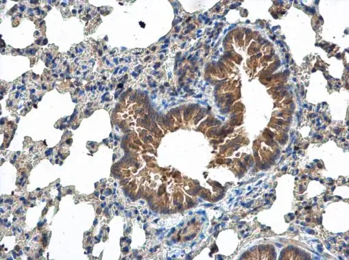 MCTS1 antibody [N1C3] detects MCTS1 protein at cytoplasm in mouse lung by immunohistochemical analysis. Sample: Paraffin-embedded mouse lung. MCTS1 antibody [N1C3] (GTX117793) diluted at 1:500. 
 Antigen Retrieval: Citrate buffer, pH 6.0, 15 min