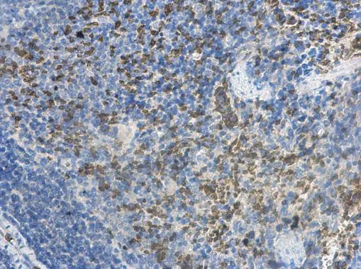 MCTS1 antibody [N1C3] detects MCTS1 protein at cytoplasm in rat spleen by immunohistochemical analysis. Sample: Paraffin-embedded rat spleen. MCTS1 antibody [N1C3] (GTX117793) diluted at 1:500. 
 Antigen Retrieval: Citrate buffer, pH 6.0, 15 min