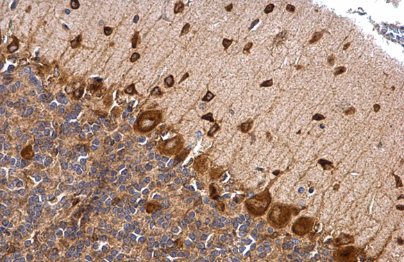 Musashi 2 antibody [N1C1] detects Musashi 2 protein at cytoplasm by immunohistochemical analysis. Sample: Paraffin-embedded rat brain. Musashi 2 stained by Musashi 2 antibody [N1C1] (GTX117808) diluted at 1:500. Antigen Retrieval: Trilogy?M (EDTA based) buffer, 15min
