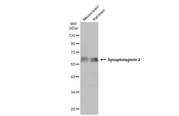 Various tissue extracts (50 μg) were separated by 10% SDS-PAGE, and the membrane was blotted with Synaptotagmin 2 antibody (GTX117819) diluted at 1:1000. The HRP-conjugated anti-rabbit IgG antibody (GTX213110-01) was used to detect the primary antibody.
