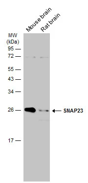 Various tissue extracts (50 μg) were separated by 12% SDS-PAGE, and the membrane was blotted with SNAP23 antibody (GTX117823) diluted at 1:500. The HRP-conjugated anti-rabbit IgG antibody (GTX213110-01) was used to detect the primary antibody.