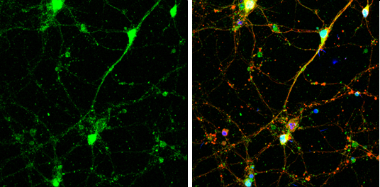 SNAP23 antibody detects SNAP23 protein at cell body and synaptic vesicles by immunofluorescent analysis. Sample: DIV9 rat E18 primary cortical neurons were fixed in 4% paraformaldehyde at RT for 15 min. Green: SNAP23 protein stained by SNAP23 antibody (GTX117823) diluted at 1:500. Red: beta Tubulin 3/ Tuj1, a neuron cell marker, stained by beta Tubulin 3/ Tuj1 antibody [GT11710] (GTX631836) diluted at 1:500. Blue: Fluoroshield with DAPI (GTX30920).