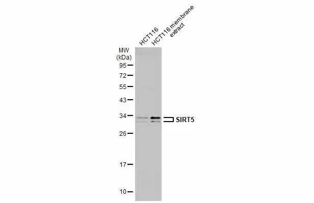 HCT116 whole cell and membrane extracts (30 μg) were separated by 12% SDS-PAGE, and the membrane was blotted with SIRT5 antibody (GTX117824) diluted at 1:500. The HRP-conjugated anti-rabbit IgG antibody (GTX213110-01) was used to detect the primary antibody. HCT116 whole cell and membrane extracts (30 μg) were separated by 12% SDS-PAGE, and the membrane was blotted with SIRT5 antibody (GTX117824) diluted at 1:500. The HRP-conjugated anti-rabbit IgG antibody (GTX213110-01) was used to detect the primary antibody.