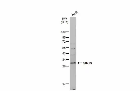 Whole cell extract (30 μg) was separated by 12% SDS-PAGE, and the membrane was blotted with SIRT5 antibody (GTX117824) diluted at 1:500. The HRP-conjugated anti-rabbit IgG antibody (GTX213110-01) was used to detect the primary antibody, and the signal was developed with Trident ECL plus-Enhanced. Whole cell extract (30 μg) was separated by 12% SDS-PAGE, and the membrane was blotted with SIRT5 antibody (GTX117824) diluted at 1:500. The HRP-conjugated anti-rabbit IgG antibody (GTX213110-01) was used to detect the primary antibody, and the signal was developed with Trident ECL plus-Enhanced.
