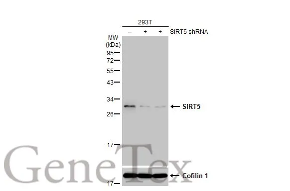 Non-transfected (–) and transfected (+) 293T whole cell extracts (30 μg) were separated by 12% SDS-PAGE, and the membrane was blotted with SIRT5 antibody (GTX117824) diluted at 1:1000. The HRP-conjugated anti-rabbit IgG antibody (GTX213110-01) was used to detect the primary antibody.