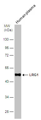 Human tissue extract (30 μg) was separated by 10% SDS-PAGE, and the membrane was blotted with LRG1 antibody (GTX117875) diluted at 1:1000. Human tissue extract (30 μg) was separated by 10% SDS-PAGE, and the membrane was blotted with LRG1 antibody (GTX117875) diluted at 1:1000.