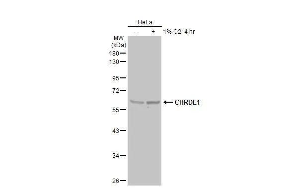 Untreated (–) and treated (+) HeLa whole cell extracts (30 μg) were separated by 10% SDS-PAGE, and the membrane was blotted with CHRDL1 antibody (GTX117884) diluted at 1:5000. The HRP-conjugated anti-rabbit IgG antibody (GTX213110-01) was used to detect the primary antibody.