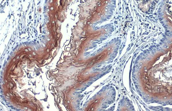 PJA2 antibody detects PJA2 protein at nucleus by immunohistochemical analysis. Sample: Paraffin-embedded mouse esophagus. PJA2 stained by PJA2 antibody (GTX117890) diluted at 1:500. Antigen Retrieval: Citrate buffer, pH 6.0, 15 min