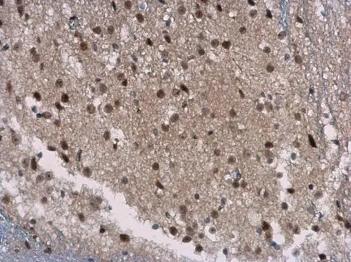 SIRT7 antibody [N2C3] detects SIRT7 protein at cytoplasm and nucleus in mouse brain by immunohistochemical analysis. Sample: Paraffin-embedded mouse brain. SIRT7 antibody [N2C3] (GTX117939) diluted at 1:400. 
 Antigen Retrieval: Citrate buffer, pH 6.0, 15 min