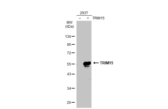 TRIM15 antibody [N2C2], Internal