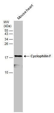 Mouse tissue extract (50 μg) was separated by 15% SDS-PAGE, and the membrane was blotted with Cyclophilin F antibody (GTX117951) diluted at 1:5000. The HRP-conjugated anti-rabbit IgG antibody (GTX213110-01) was used to detect the primary antibody.