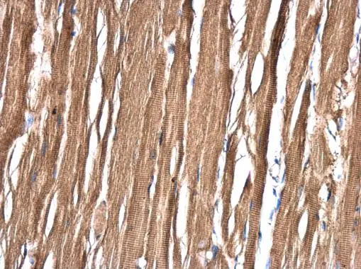 ASB8 antibody detects ASB8 protein at cytoplasm in rat skin by immunohistochemical analysis. Sample: Paraffin-embedded rat skin. ASB8 antibody (GTX117973) diluted at 1:500. 
 Antigen Retrieval: Citrate buffer, pH 6.0, 15 min