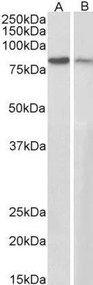 WB analysis of A431 (A) and NIH-3T3 (B) cell lysates using GTX11799 gamma Catenin antibody, C-term. Dilution : 0.3microg/ml Loading : 35microg protein in RIPA buffer