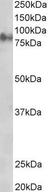 WB analysis of rat eye lysate using GTX11799 gamma Catenin antibody, C-term. Dilution : 1microg/ml Loading : 35microg protein in RIPA buffer
