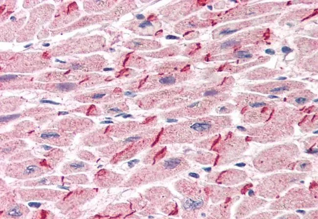 IHC-P analysis of human heart using GTX11799 gamma Catenin antibody, C-term. Antigen retrieval : citrate buffer pH 6 Dilution : 5microg/ml