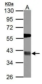 Sample (50 μg of whole cell lysate) A: mouse brain 10% SDS PAGE GTX117994 diluted at 1:500 The HRP-conjugated anti-rabbit IgG antibody (GTX213110-01) was used to detect the primary antibody.