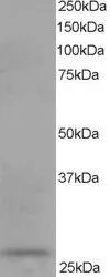 WB analysis of human kidney lysate using GTX11800 DCXR antibody, C-term. Dilution : 0.1microg/ml Loading : 35microg protein in RIPA buffer WB analysis of human kidney lysate using GTX11800 DCXR antibody, C-term. Dilution : 0.1microg/ml Loading : 35microg protein in RIPA buffer