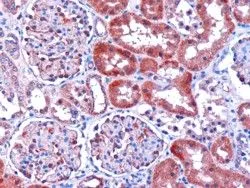 IHC-P analysis of human kidney using GTX11800 DCXR antibody, C-term. Antigen retrieval : citrate buffer pH 6 Dilution : 1microg/ml
