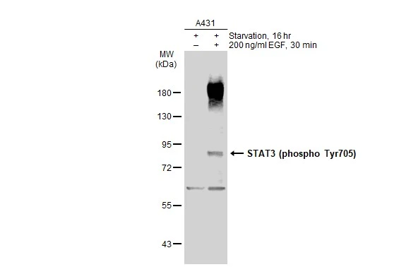 ⭐️pです Anti-STAT3 (phospho Tyr705) antibody (GTX118000) | GeneTex