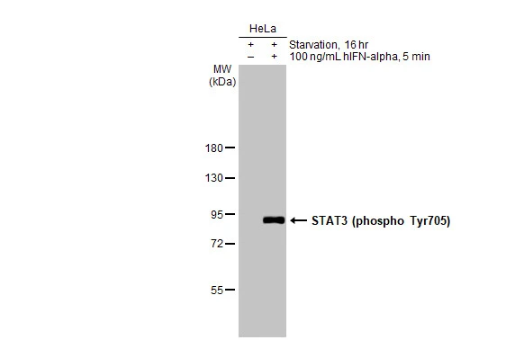 Untreated (–) and treated (+) HeLa whole cell extracts (30 μg) were separated by 7.5% SDS-PAGE, and the membrane was blotted with STAT3 (phospho Tyr705) antibody (GTX118000) diluted at 1:1000. The HRP-conjugated anti-rabbit IgG antibody (GTX213110-01) was used to detect the primary antibody, and the signal was developed with Trident ECL plus-Enhanced.
