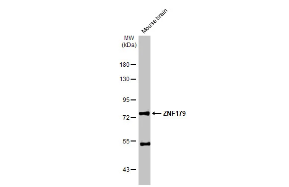 ZNF179 antibody
