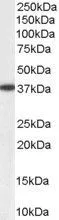 WB analysis of human liver lysate using GTX11802 AKR1A1 antibody, C-term. Dilution : 0.1microg/ml Loading : 35microg protein in RIPA buffer WB analysis of human liver lysate using GTX11802 AKR1A1 antibody, C-term. Dilution : 0.1microg/ml Loading : 35microg protein in RIPA buffer