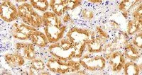 IHC-P analysis of human kidney using GTX11802 AKR1A1 antibody, C-term. Antigen retrieval : citrate buffer pH 6 Dilution : 2.5microg/ml