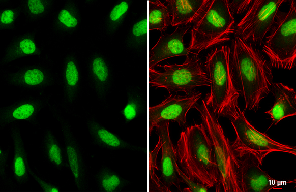 Homeobox C10 antibody detects Homeobox C10 protein at nucleus by immunofluorescent analysis. Sample: HeLa cells were fixed in 4% paraformaldehyde at RT for 15 min. Green: Homeobox C10 stained by Homeobox C10 antibody (GTX118025) diluted at 1:500. Red: phalloidin, a cytoskeleton marker, diluted at 1:100. Scale bar= 10 μm.
