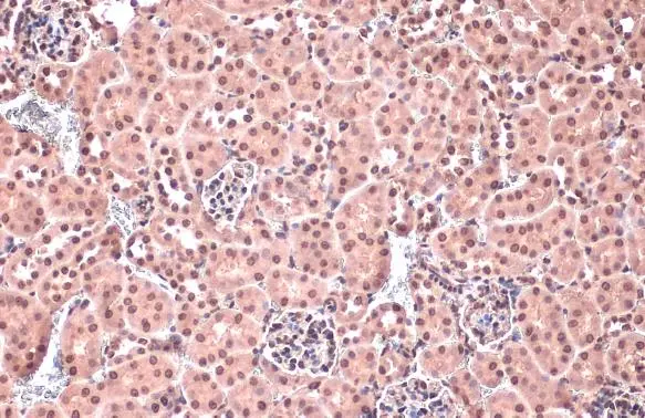 Homeobox C10 antibody detects Homeobox C10 protein at nucleus by immunohistochemical analysis. Sample: Paraffin-embedded mouse kidney. Homeobox C10 stained by Homeobox C10 antibody (GTX118025) diluted at 1:500. Antigen Retrieval: Citrate buffer, pH 6.0, 15 min