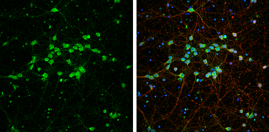 GDF10 antibody [N3C3] detects GDF10 protein at cell body by immunofluorescent analysis. Sample: DIV9 rat E18 primary cortical neurons were fixed in 4% paraformaldehyde at RT for 15 min. Green: GDF10 protein stained by GDF10 antibody [N3C3] (GTX118039) diluted at 1:500. Red: beta Tubulin 3/ Tuj1, stained by beta Tubulin 3/ Tuj1 antibody [GT11710] (GTX631836) diluted at 1:500. Blue: Fluoroshield with DAPI (GTX30920).