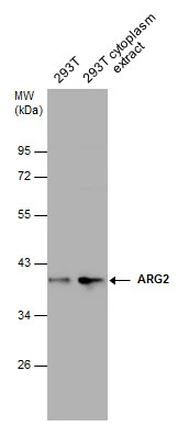 293T whole cell and cytoplasm extracts (30 μg) were separated by 10% SDS-PAGE, and the membrane was blotted with ARG2 antibody (GTX118048) diluted at 1:1000.