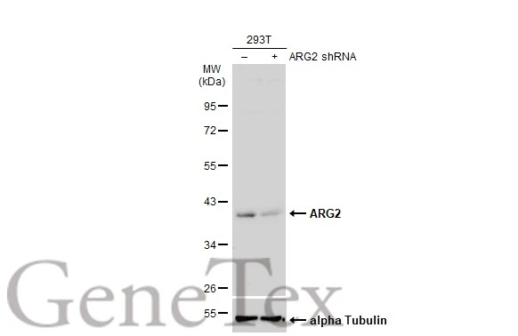 Non-transfected (–) and transfected (+) 293T whole cell extracts (50 μg) were separated by 10% SDS-PAGE, and the membrane was blotted with ARG2 antibody (GTX118048) diluted at 1:2000. The HRP-conjugated anti-rabbit IgG antibody (GTX213110-01) was used to detect the primary antibody.