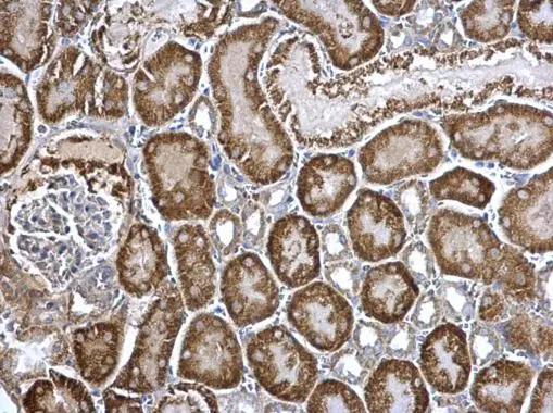 ARG2 antibody detects ARG2 protein at mitochondria on mouse kidney by immunohistochemical analysis. Sample: Paraffin-embedded mouse kidney. ARG2 antibody (GTX118048) dilution: 1:500. 
 Antigen Retrieval: Trilogy? (EDTA based, pH 8.0) buffer, 15min