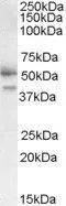 WB analysis of placenta lysate using GTX11805 FSTL1 antibody, C-term. Dilution : 0.3microg/ml Loading : 35microg protein in RIPA buffer WB analysis of placenta lysate using GTX11805 FSTL1 antibody, C-term. Dilution : 0.3microg/ml Loading : 35microg protein in RIPA buffer